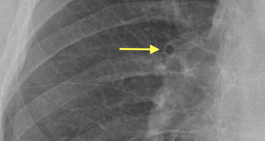 Teaching Medicine Tutorial Congestive Heart Failure